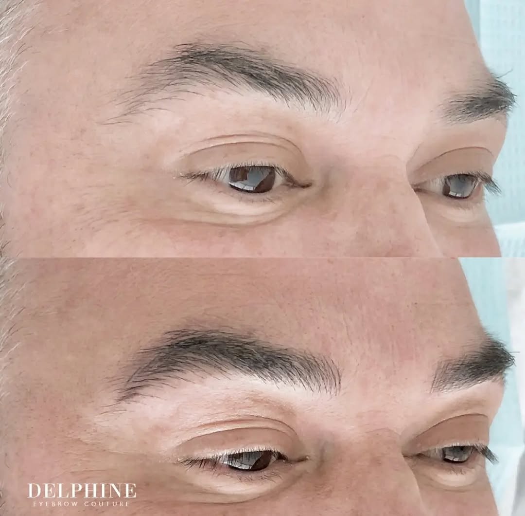 Eyebrow restoration before and after by Delphine