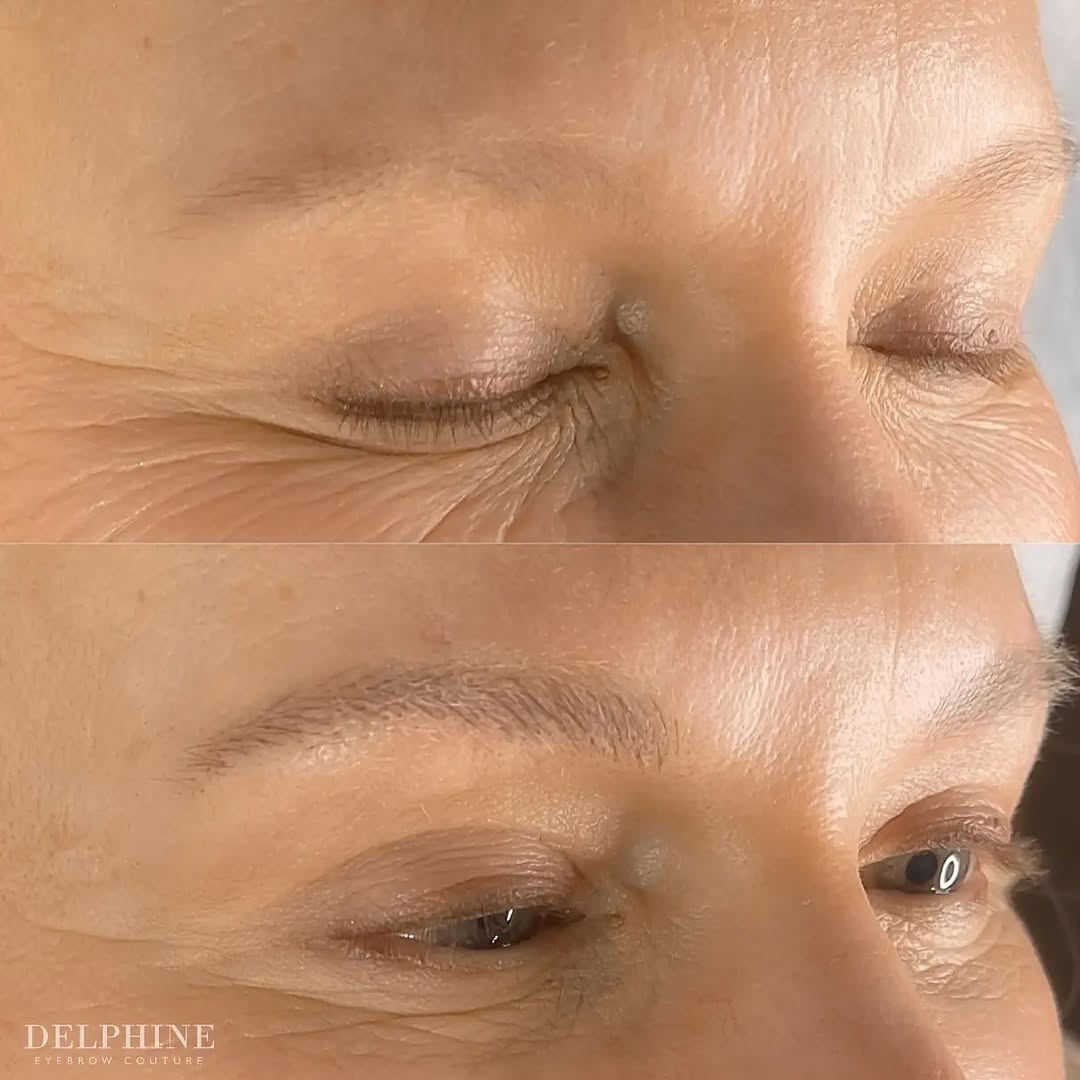 Eyebrow restoration before and after by Delphine