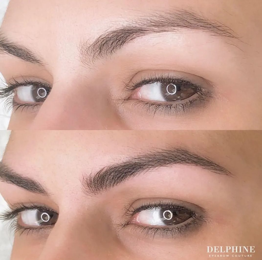 Eyebrow restoration before and after by Delphine