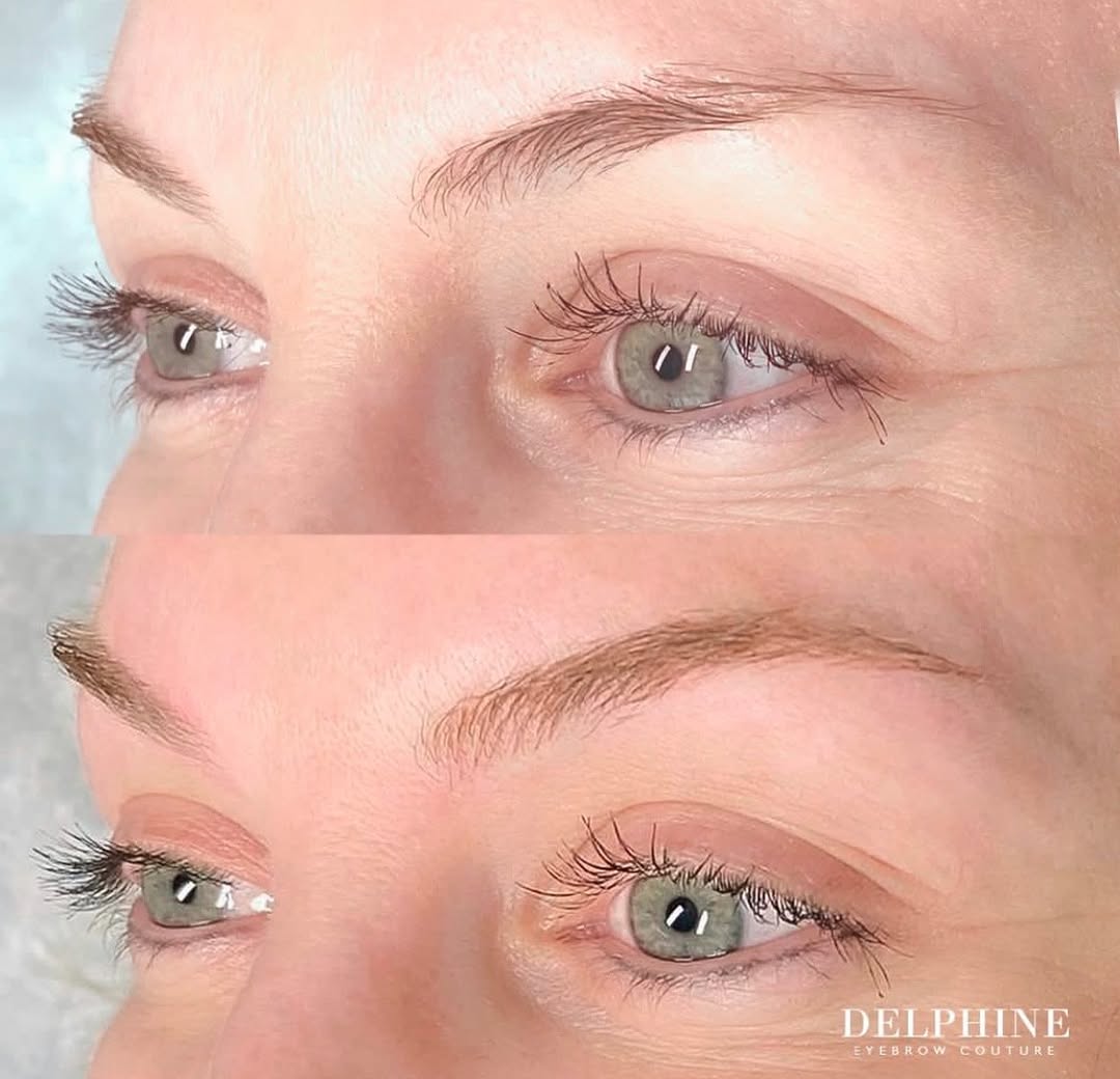 Eyebrow restoration before and after by Delphine