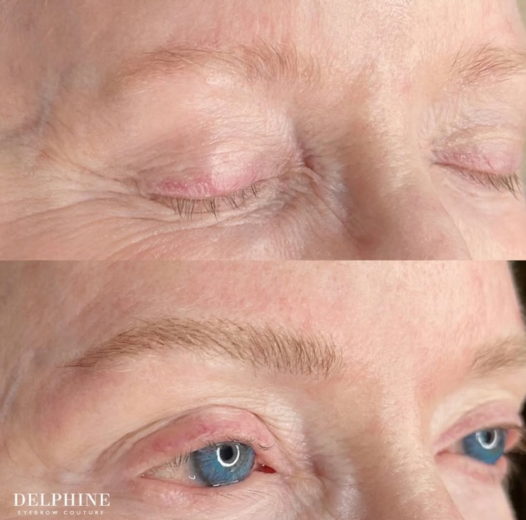 Eyebrow restoration before and after by Delphine