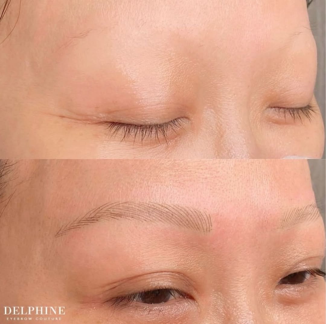 Eyebrow restoration before and after by Delphine