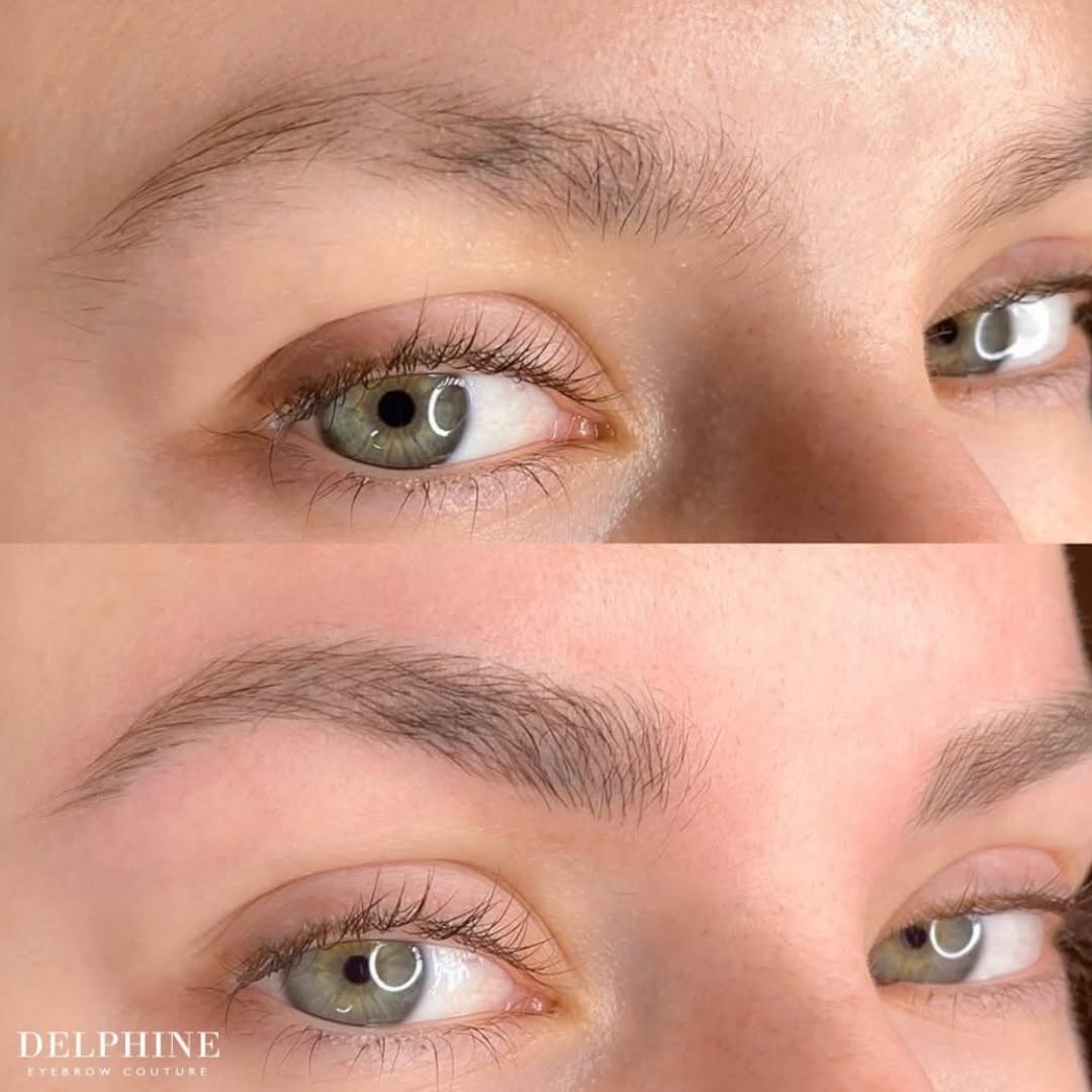 Eyebrow restoration before and after by Delphine