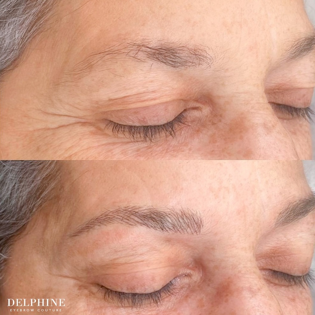 Eyebrow restoration before and after by Delphine