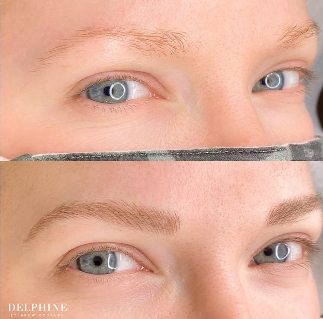 Eyebrow restoration before and after by Delphine