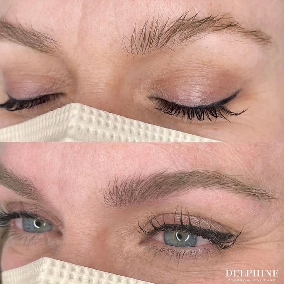 Eyebrow restoration before and after by Delphine
