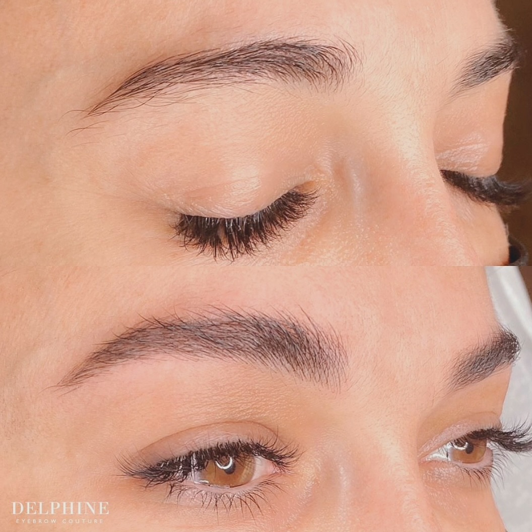 Eyebrow restoration before and after by Delphine