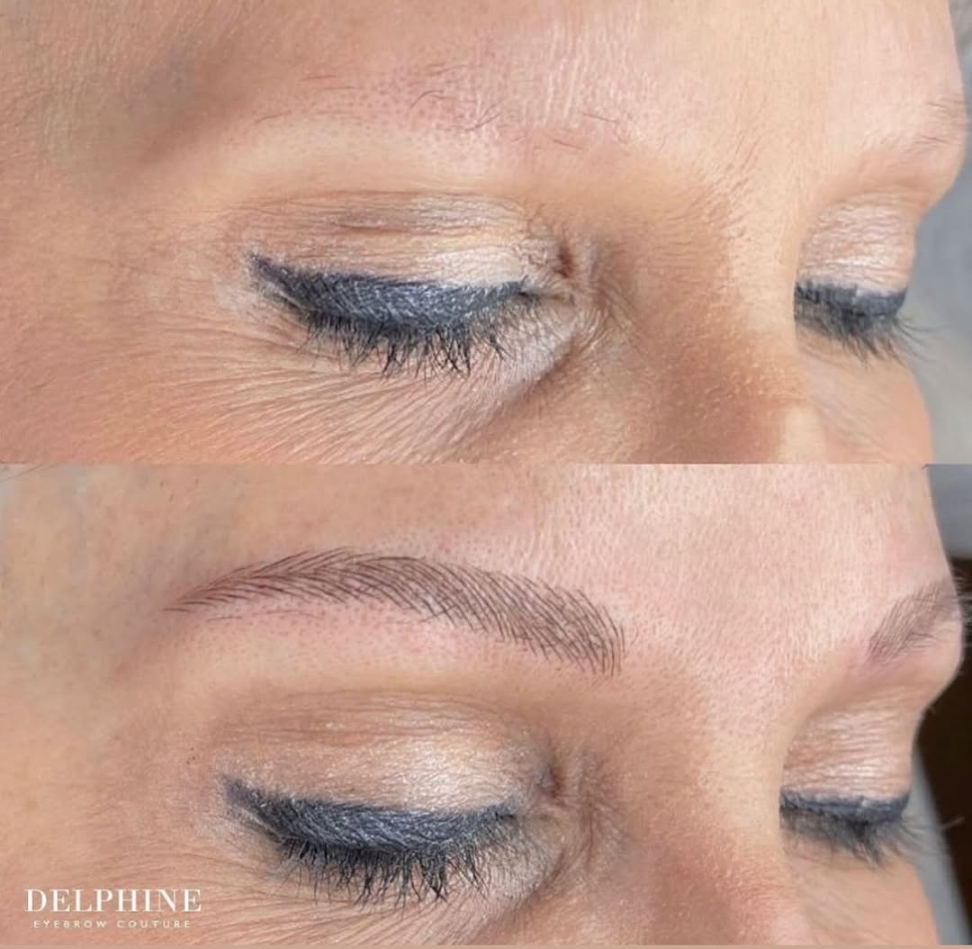 Eyebrow restoration before and after by Delphine