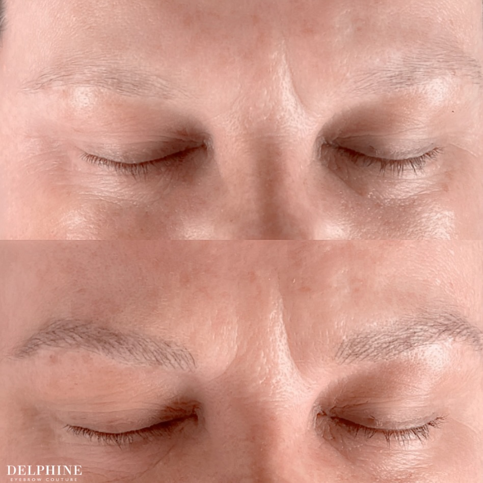Eyebrow restoration before and after by Delphine