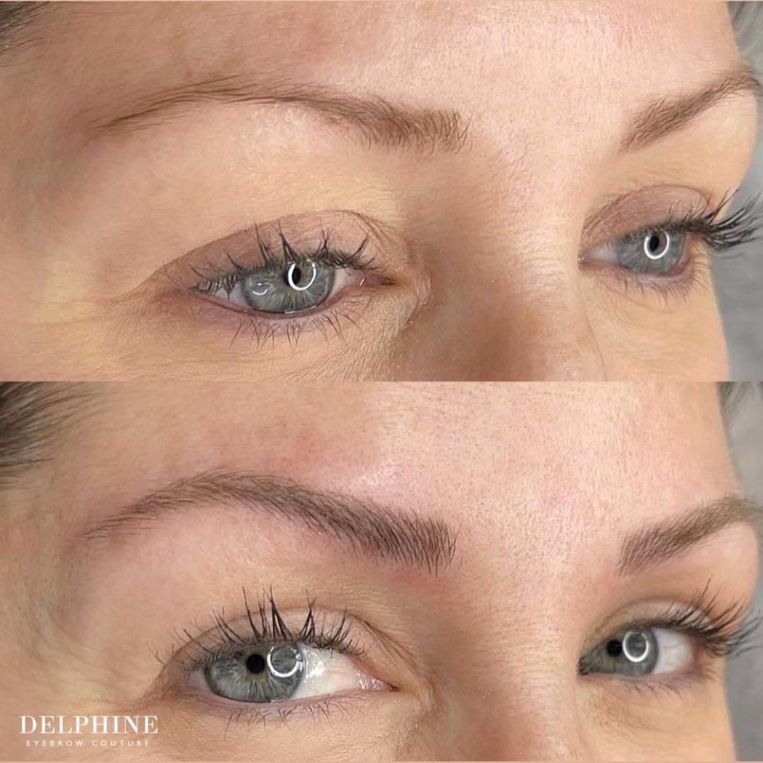 Eyebrow restoration before and after by Delphine