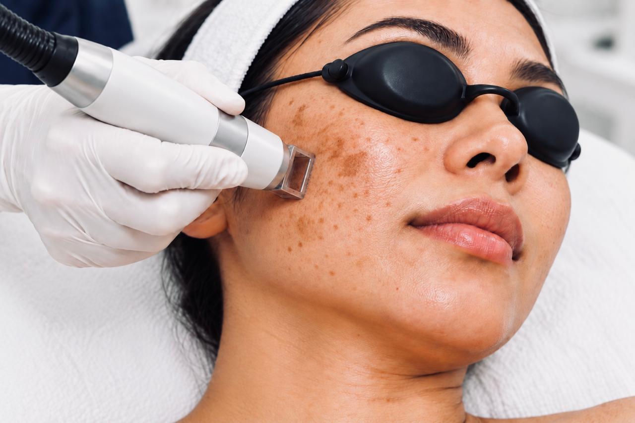 Clinician wearing protective laser glasses performing a Thulium laser treatment