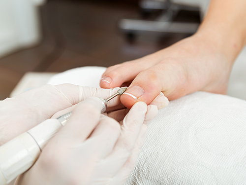  Pedicure