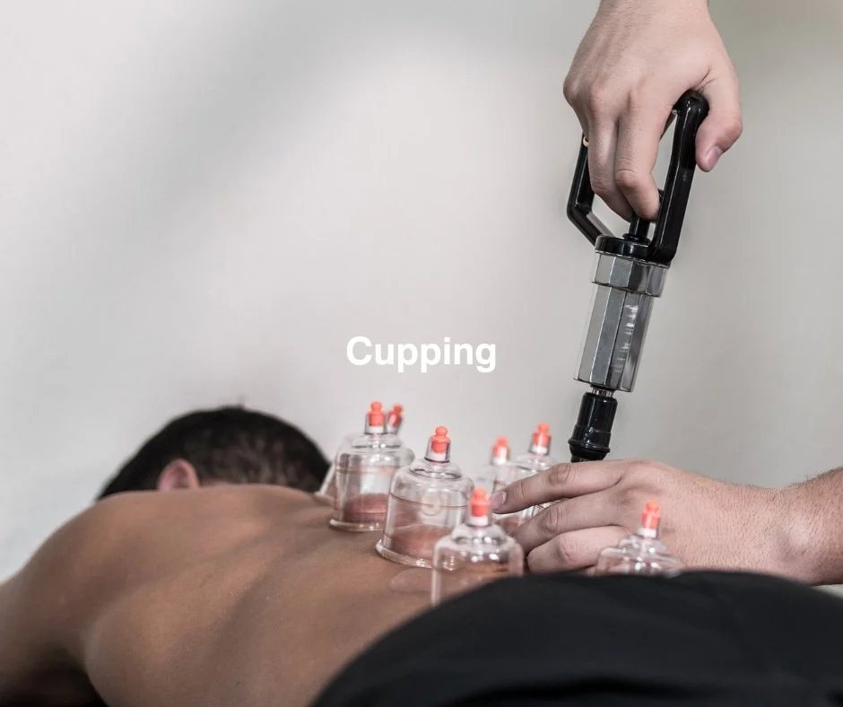 Myofascial cupping on a back