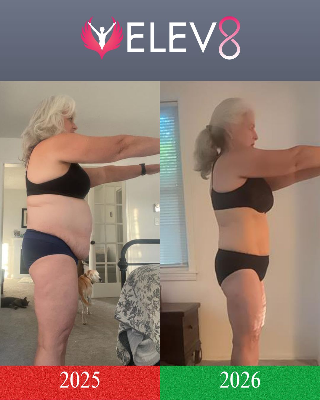 Becky — before and after