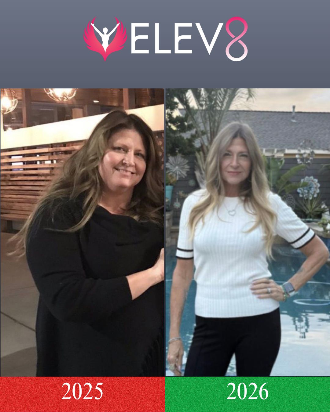 Teresa — before and after