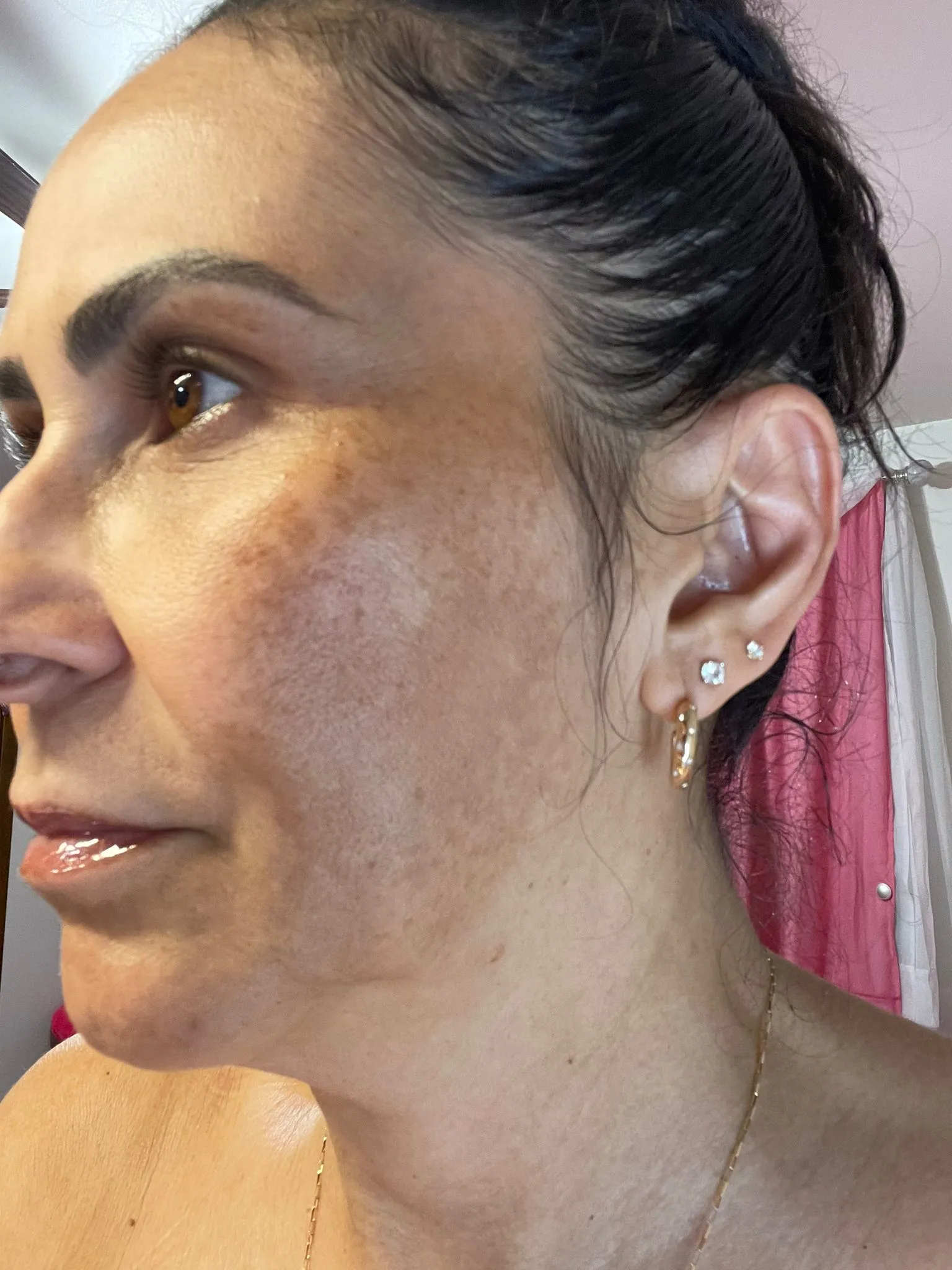 Sandra — before