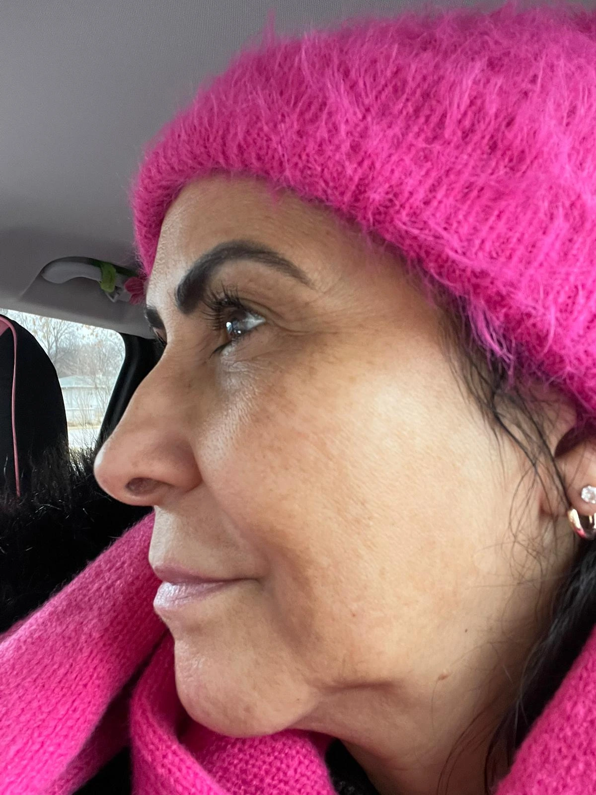 Sandra — after