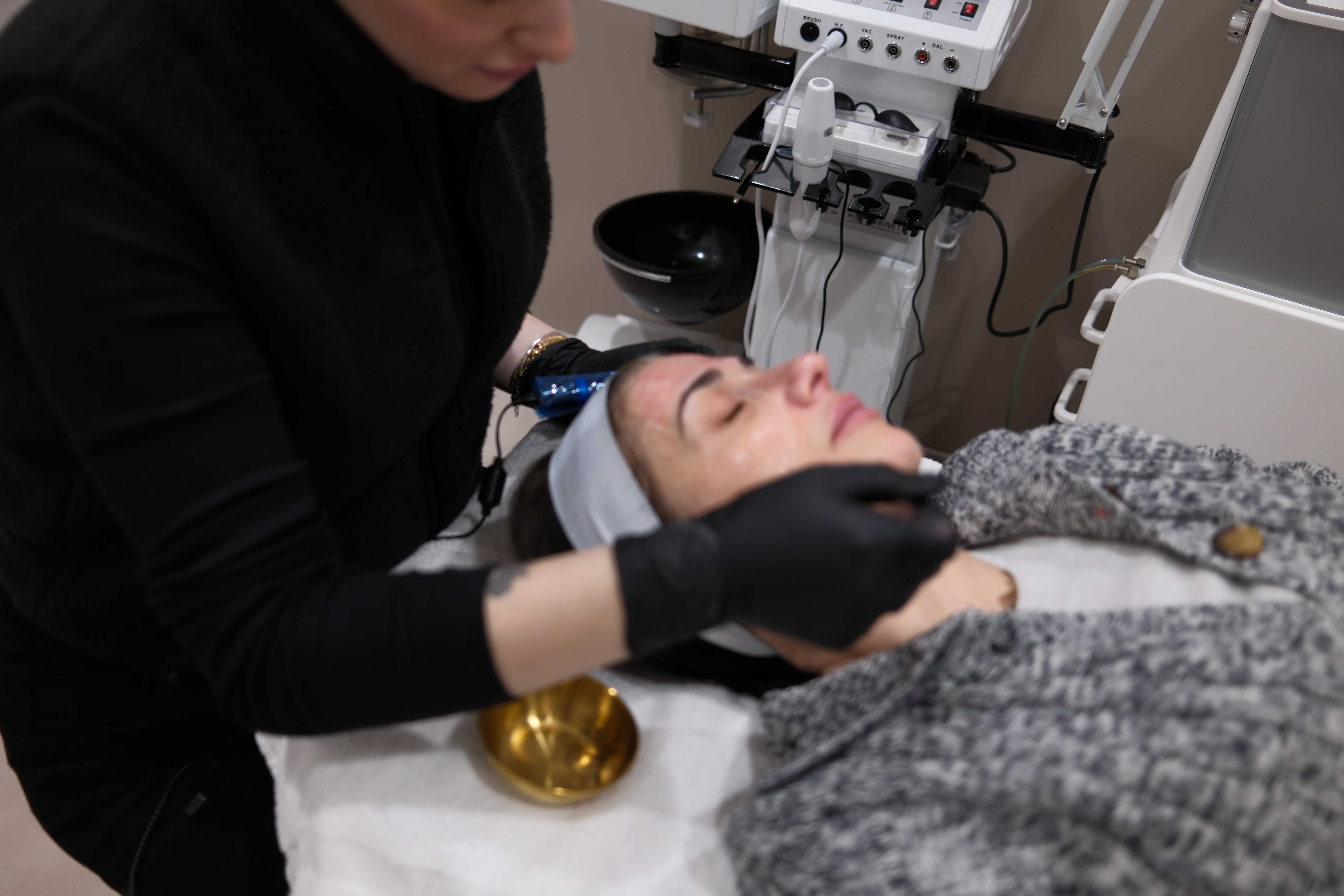 Demma Aesthetics provider performing a microneedling treatment on a Boston patient