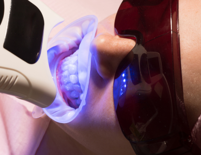 Laser treatment for canker sores