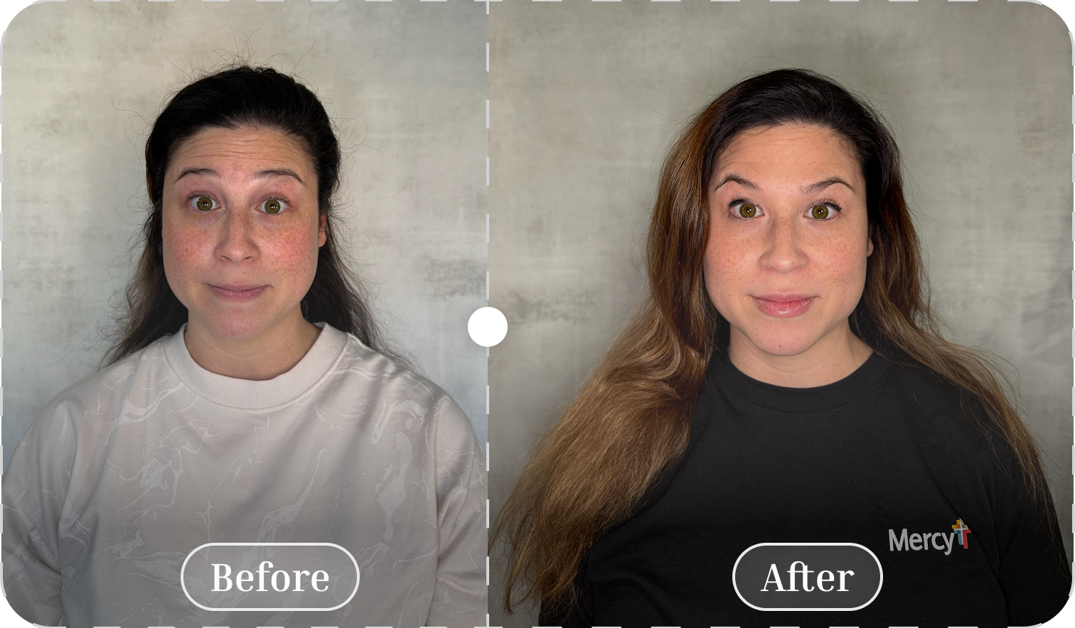 Before and after patient result 2