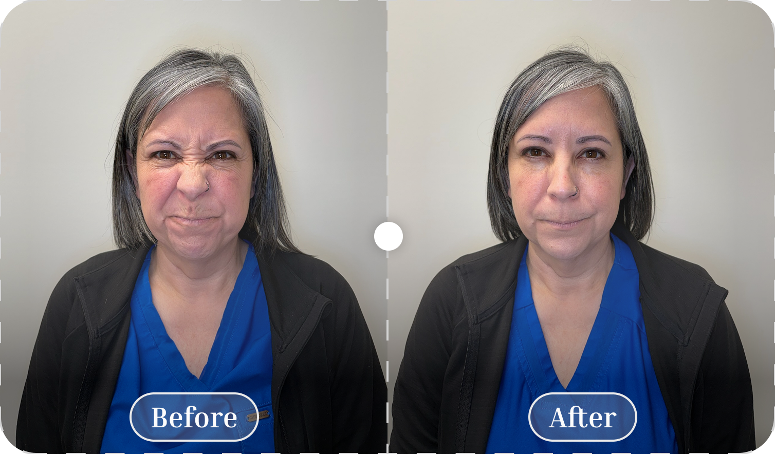 Before and after patient result 1