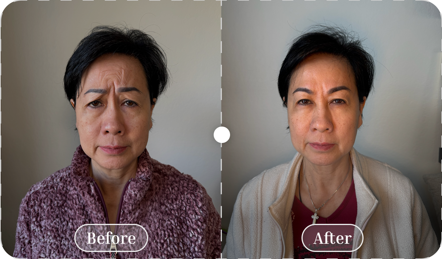 Before and after patient result 3