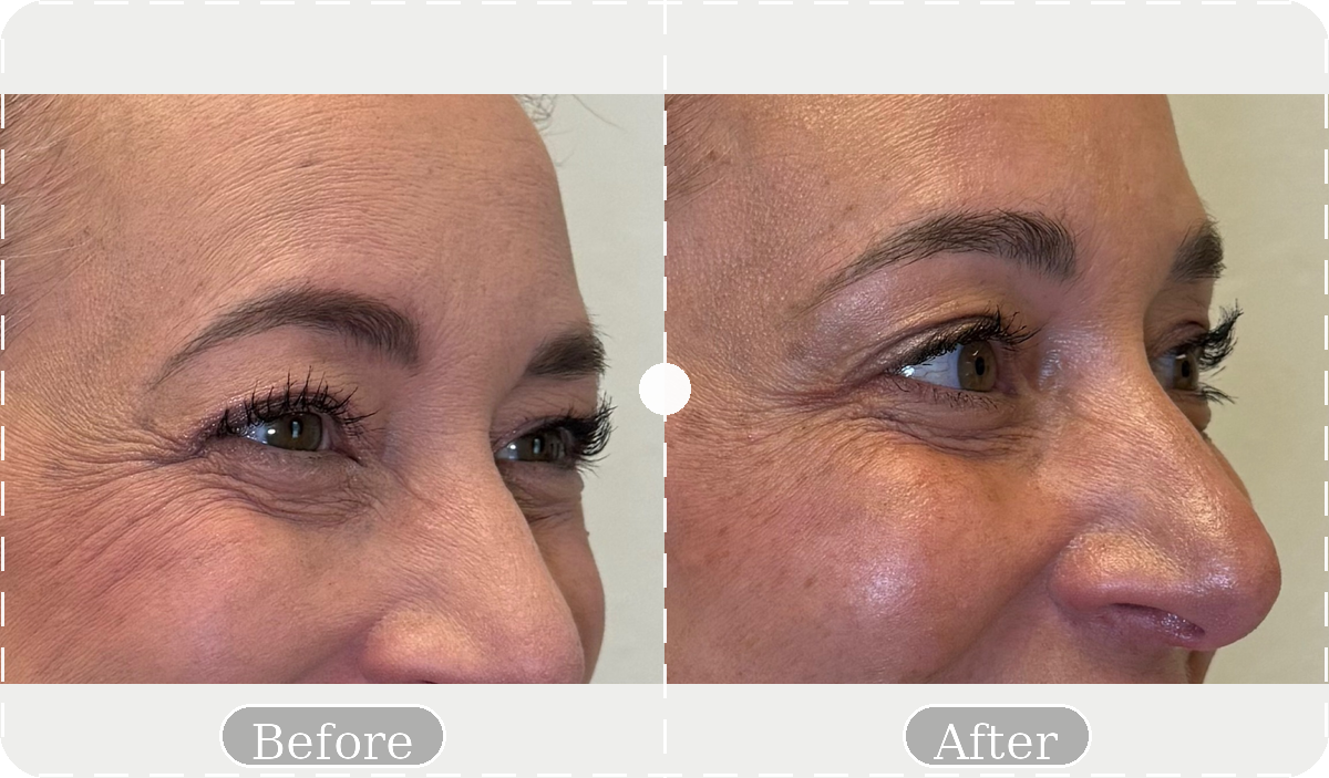 Before and after patient result 5