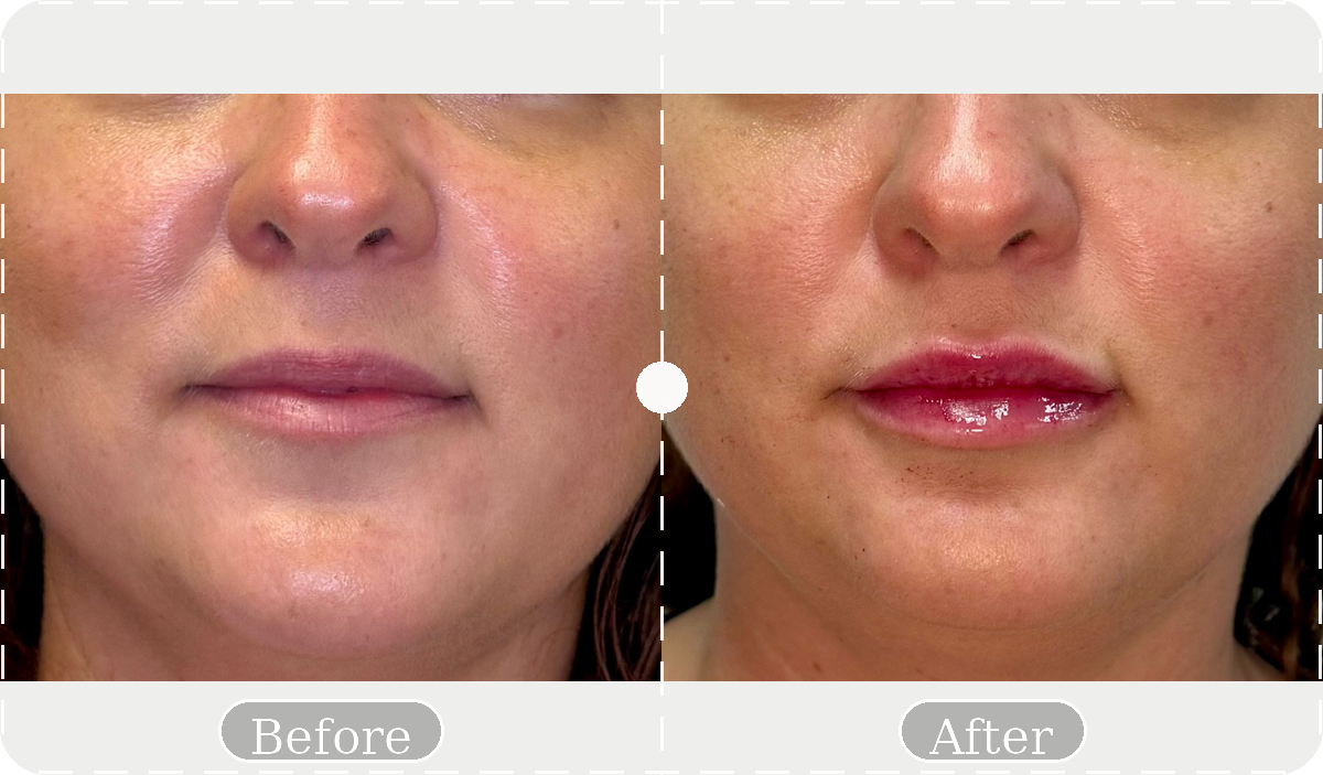 Before and after patient result 6