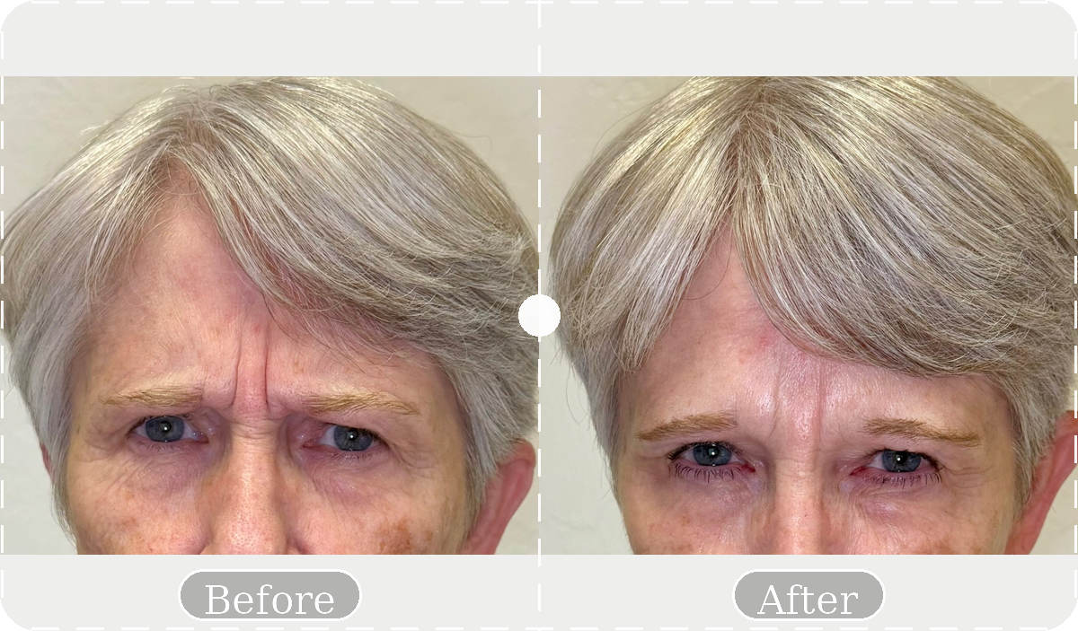 Before and after patient result 4