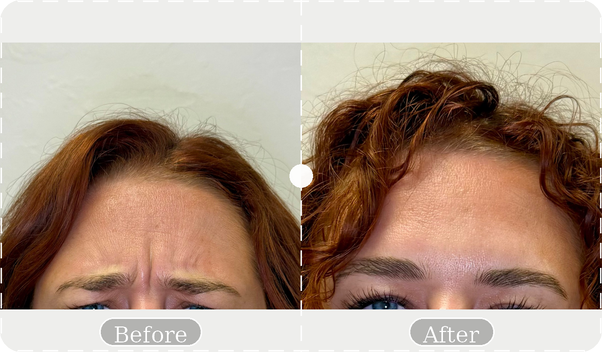 Before and after patient result 7