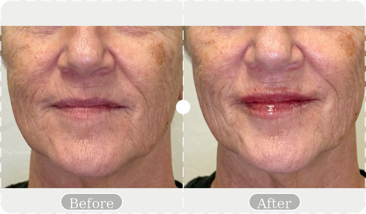 Before and after patient result 10