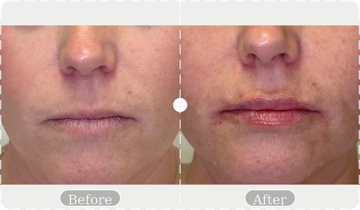 Before and after patient result 8