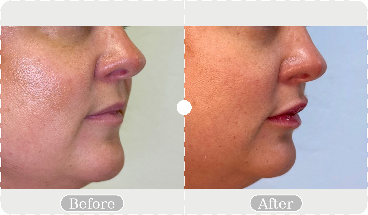 Before and after patient result 18