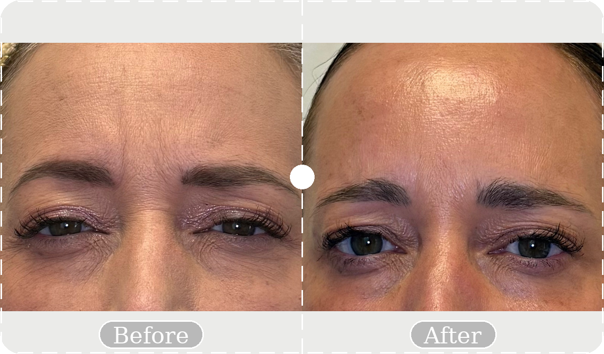 Before and after patient result 14