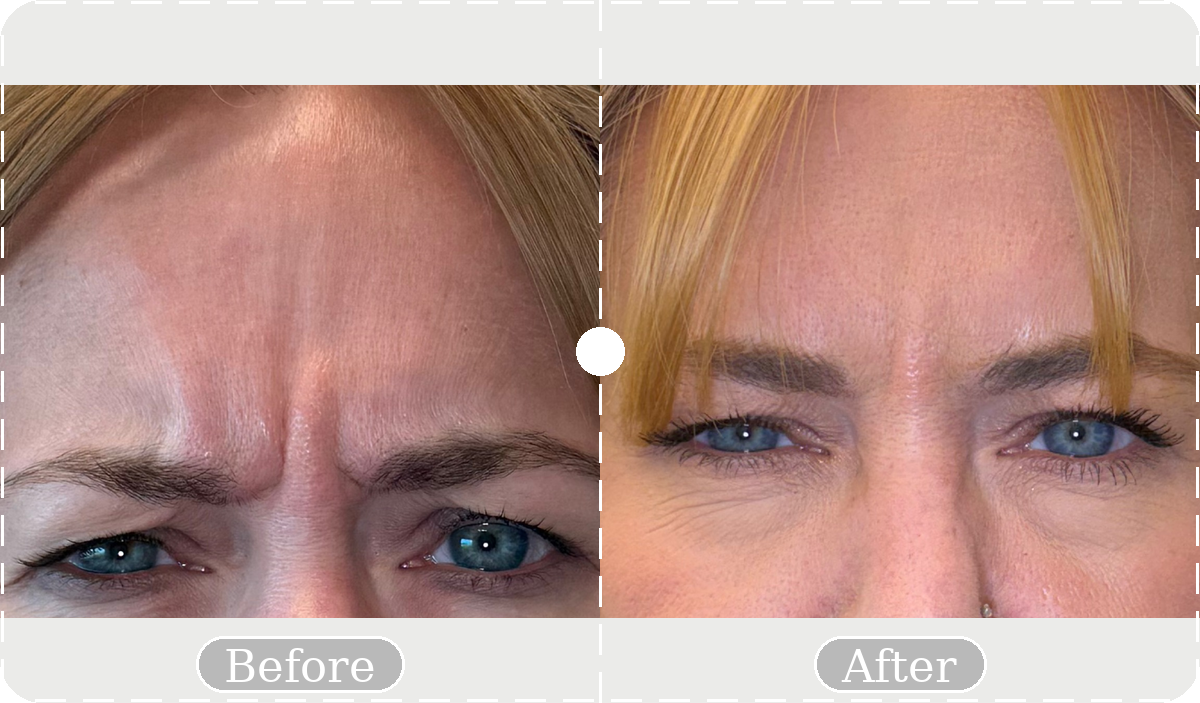 Before and after patient result 17