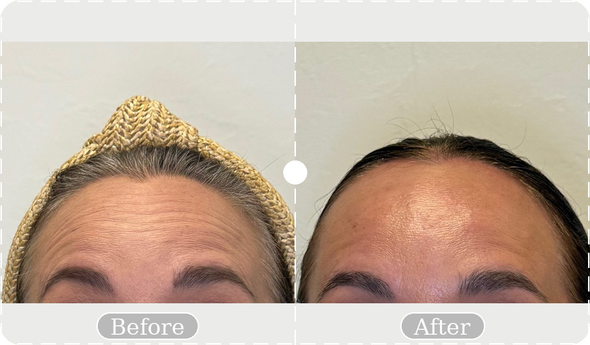 Before and after patient result 15