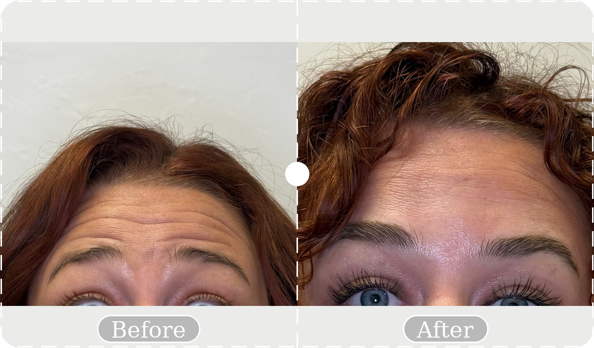 Before and after patient result 19