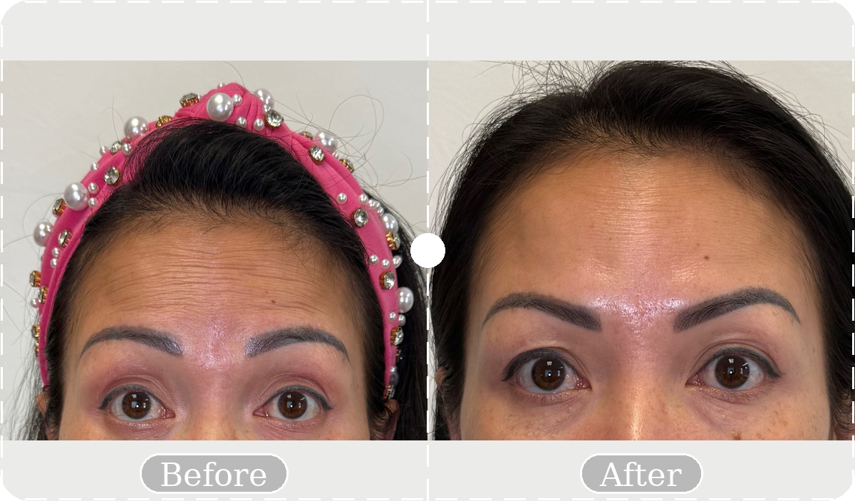 Before and after patient result 16