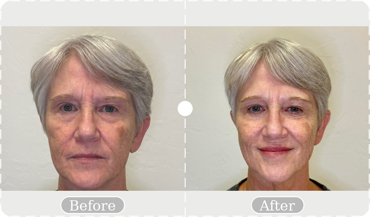 Before and after patient result 12