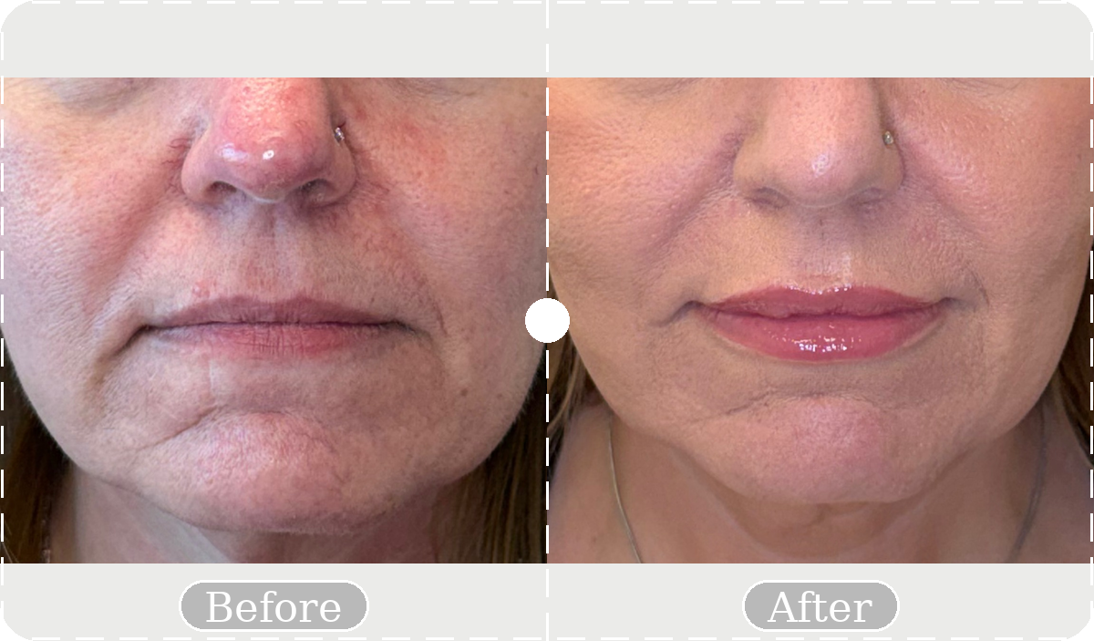 Before and after patient result 13