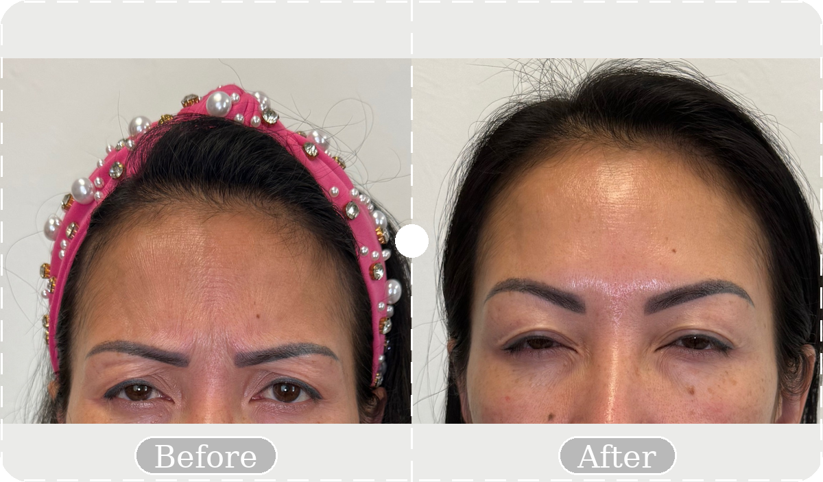 Before and after patient result 11