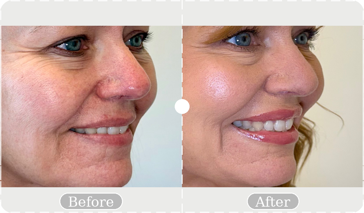 Before and after patient result 9