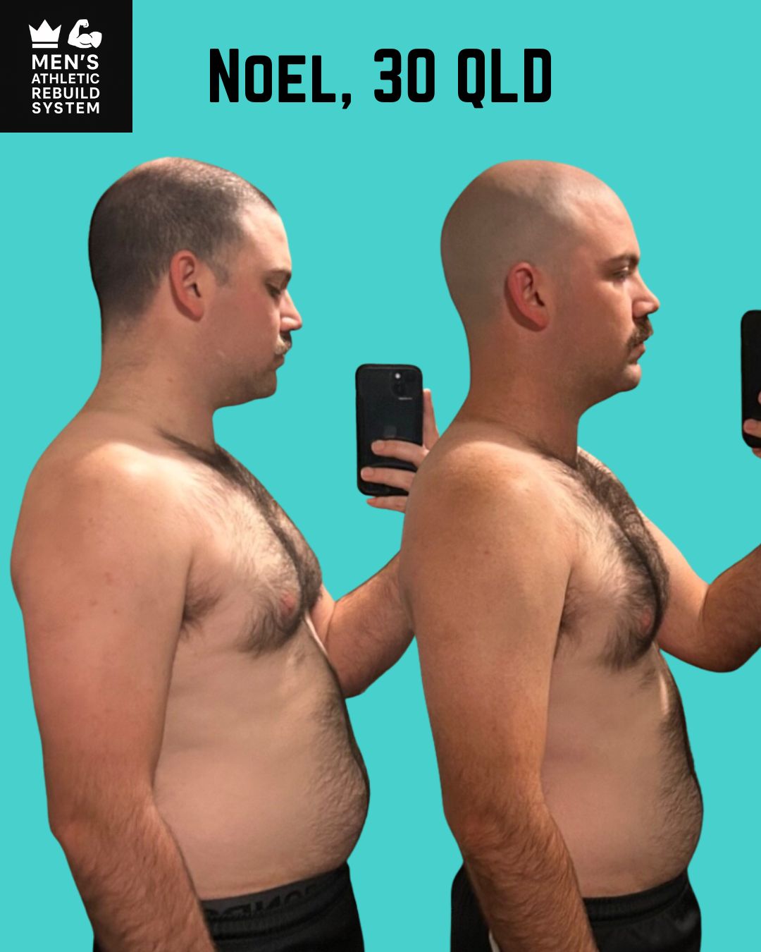 Noel Vollmerhause