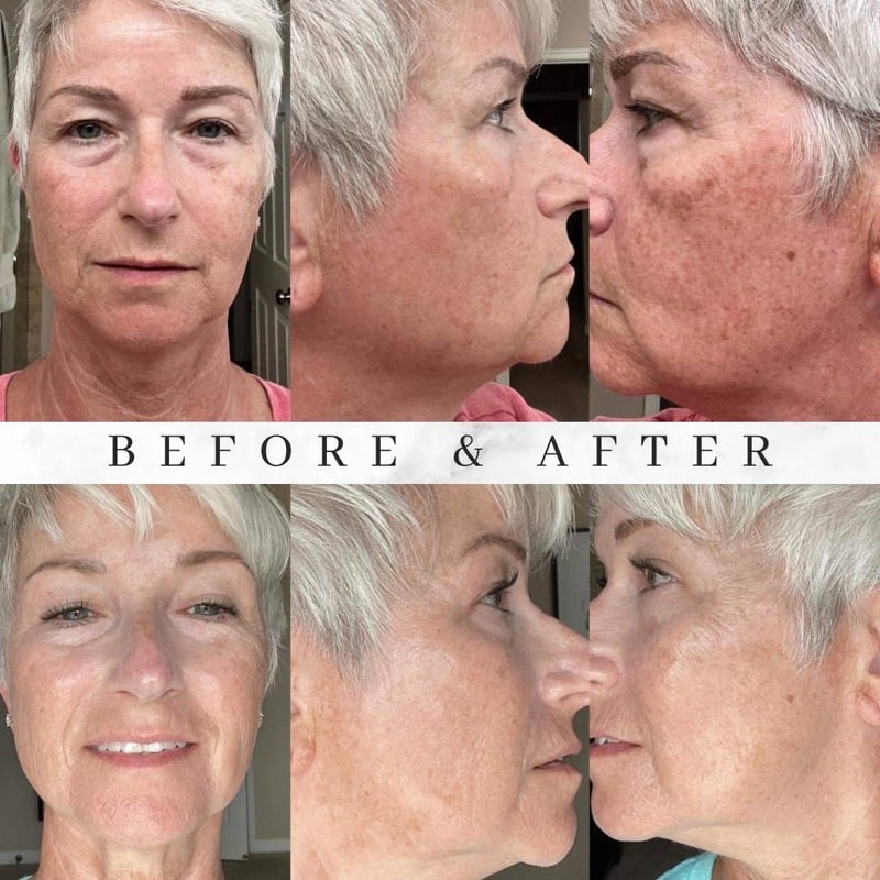 Before and after skincare result 1
