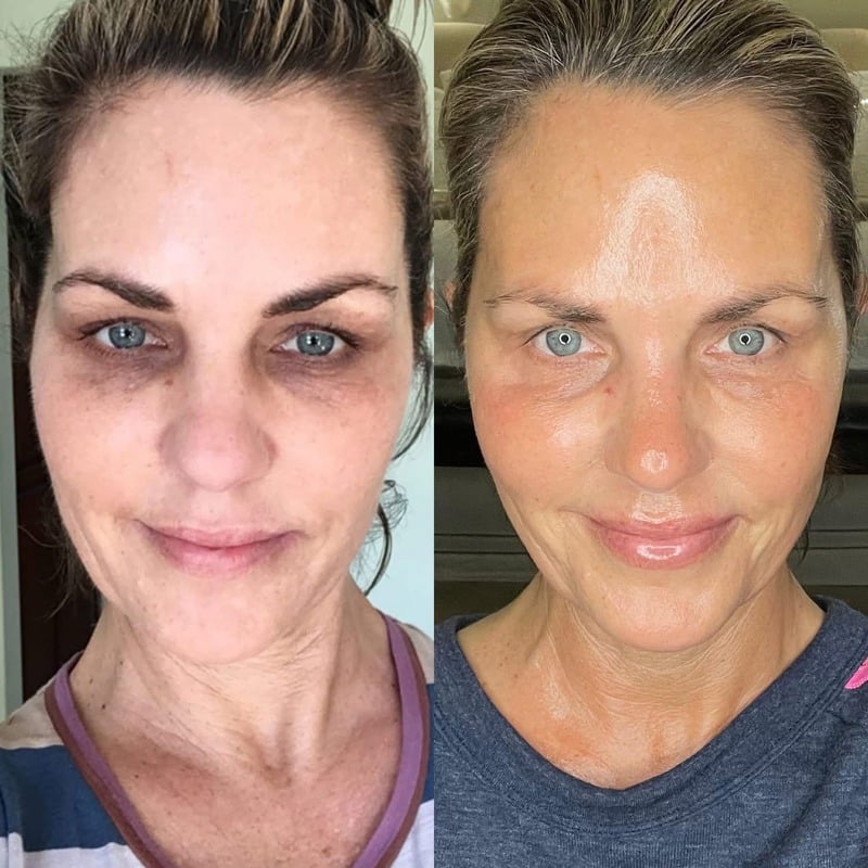 Before and after skincare result 8