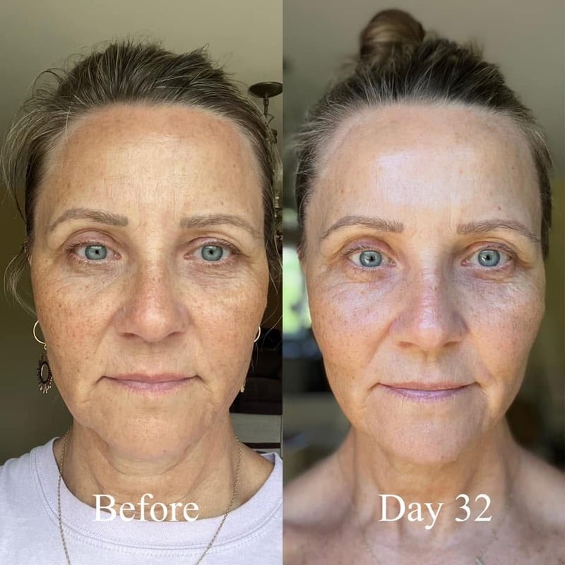 Before and after skincare result 9