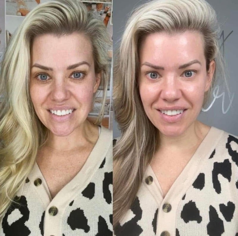 Before and after skincare result 11