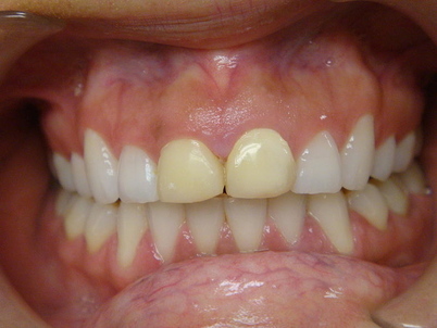 Teeth Gallery 9
