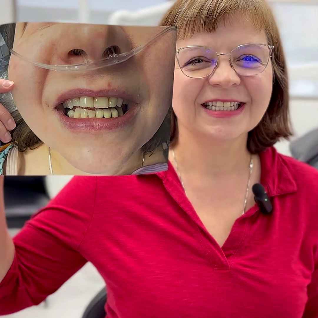 A Clarity Dental & Implant patient smiling at their new teeth