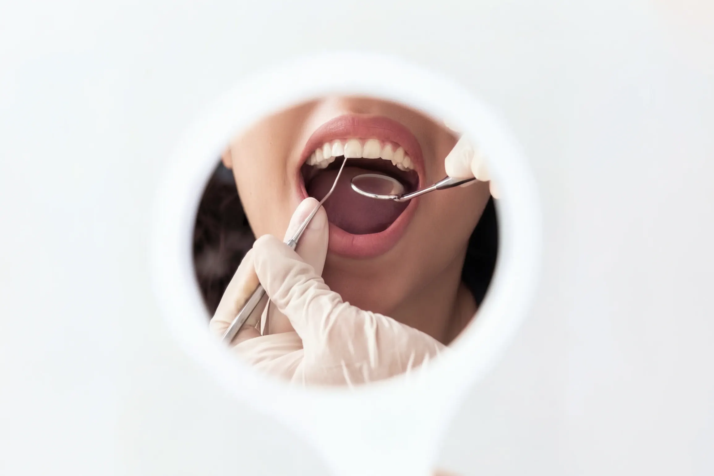 Dental examination seen through a round mirror